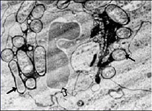 Transmissionselektronenmikroskopische Darstellung von Yersinien (ž) in lymphatischem Gewebe