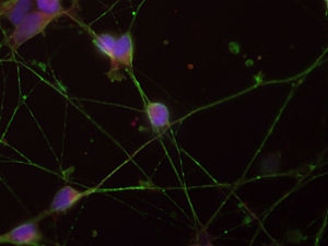Human dopaminergic neuron 