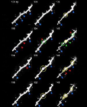 Prionprotein an hippocampalen exzitatorischen Synapsen Prionprotein an hippocampalen exzitatorischen Synapsen