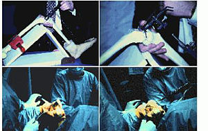 FORWISS-Software für Kniegelenk-Implantationen