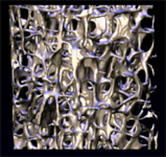 für Tissue Engineering geometrieoptimierte Custom-Implantate