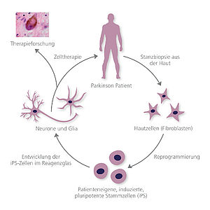 FORIPS - Krankheitsmodelle auf Basis induzierter pluripotenter Stammzellen
